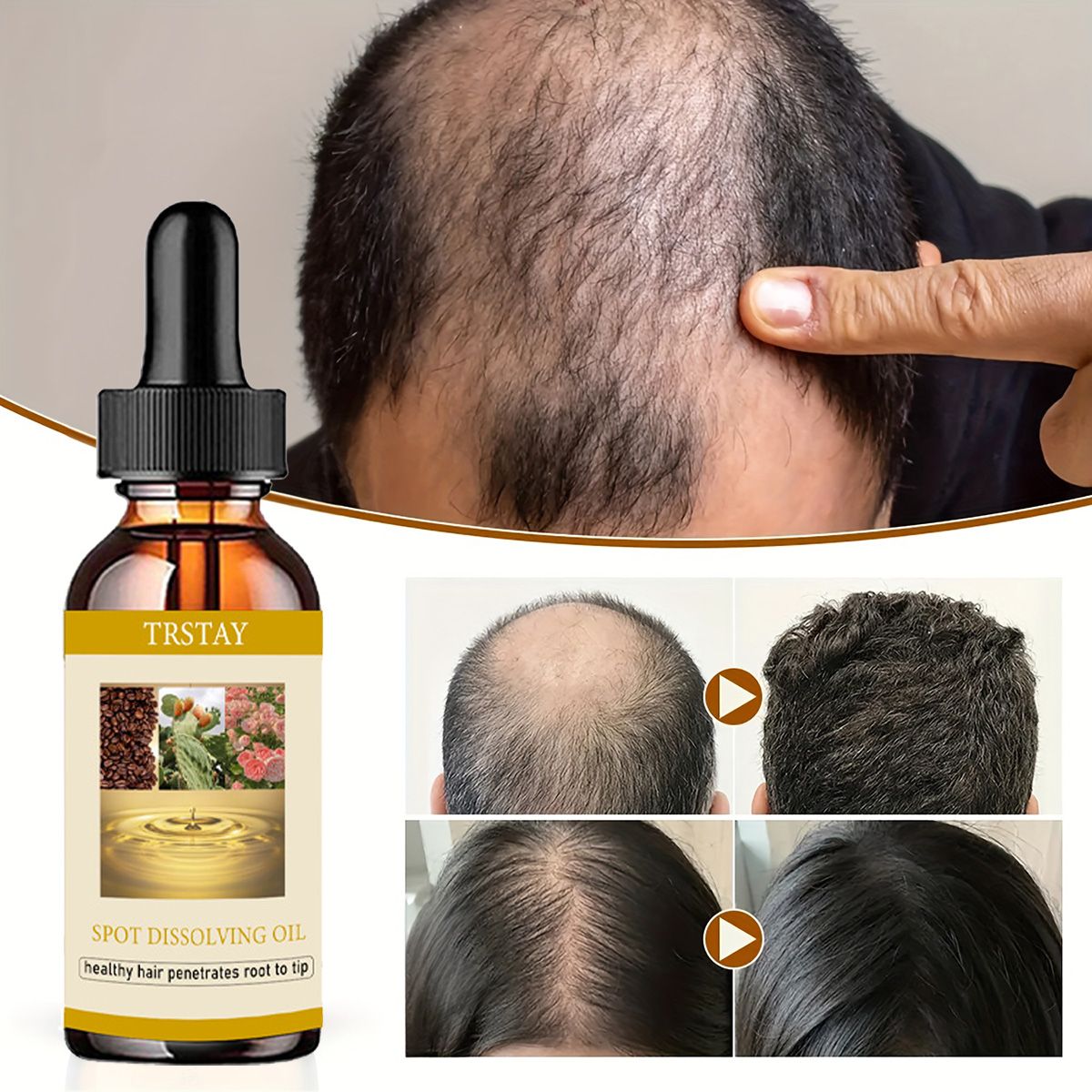 Beard Oil - 50ML Minyak Pertumbuhan Jenggot Anti Alopecia