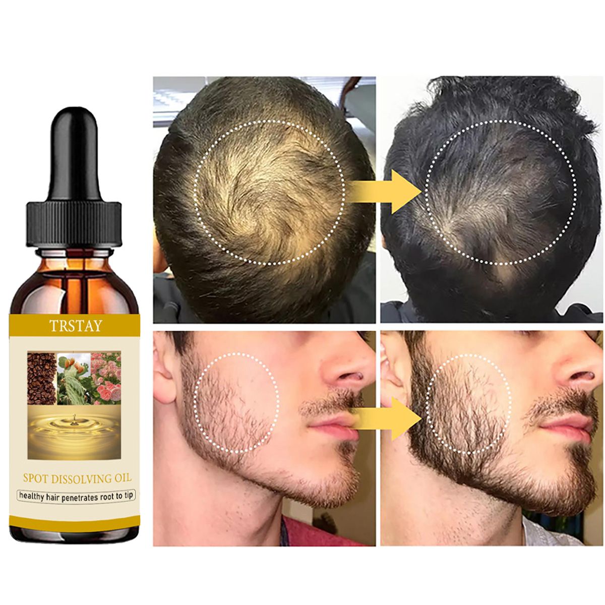 50ML Minyak Pertumbuhan Jenggo - Beard Oil ulasan dan harga