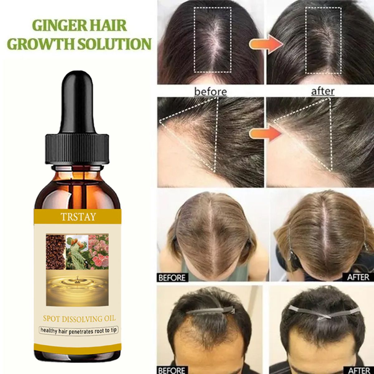 50ML Minyak Pertumbuhan Jenggo - Beard Oil ulasan dan harga
